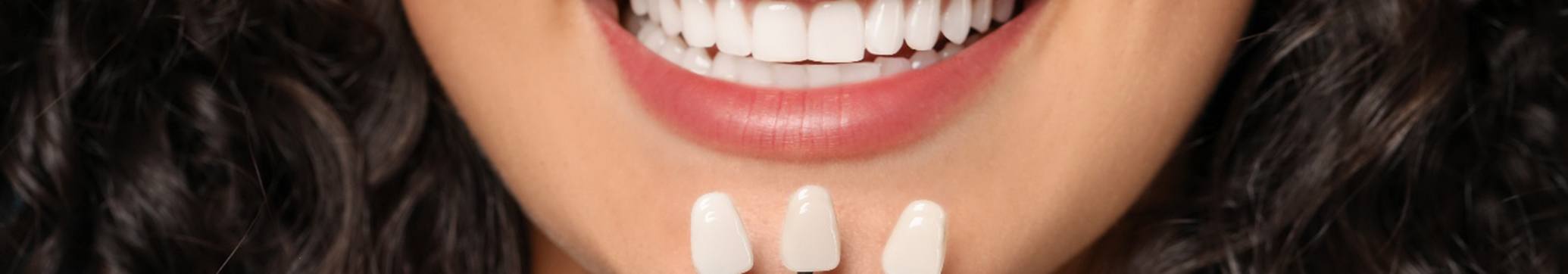 Nose-to-neck view of woman with perfect teeth smiling with shade guide held up